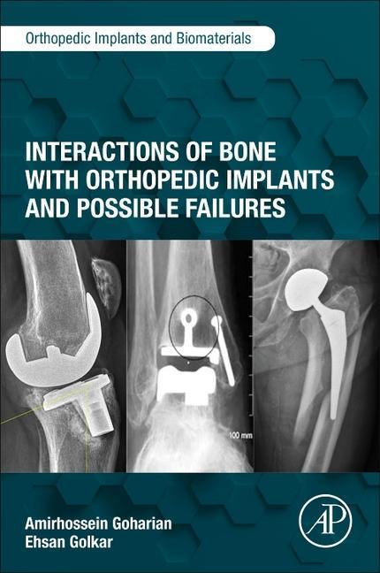 Interactions of Bone with Orthopedic Implants and Possible Failures