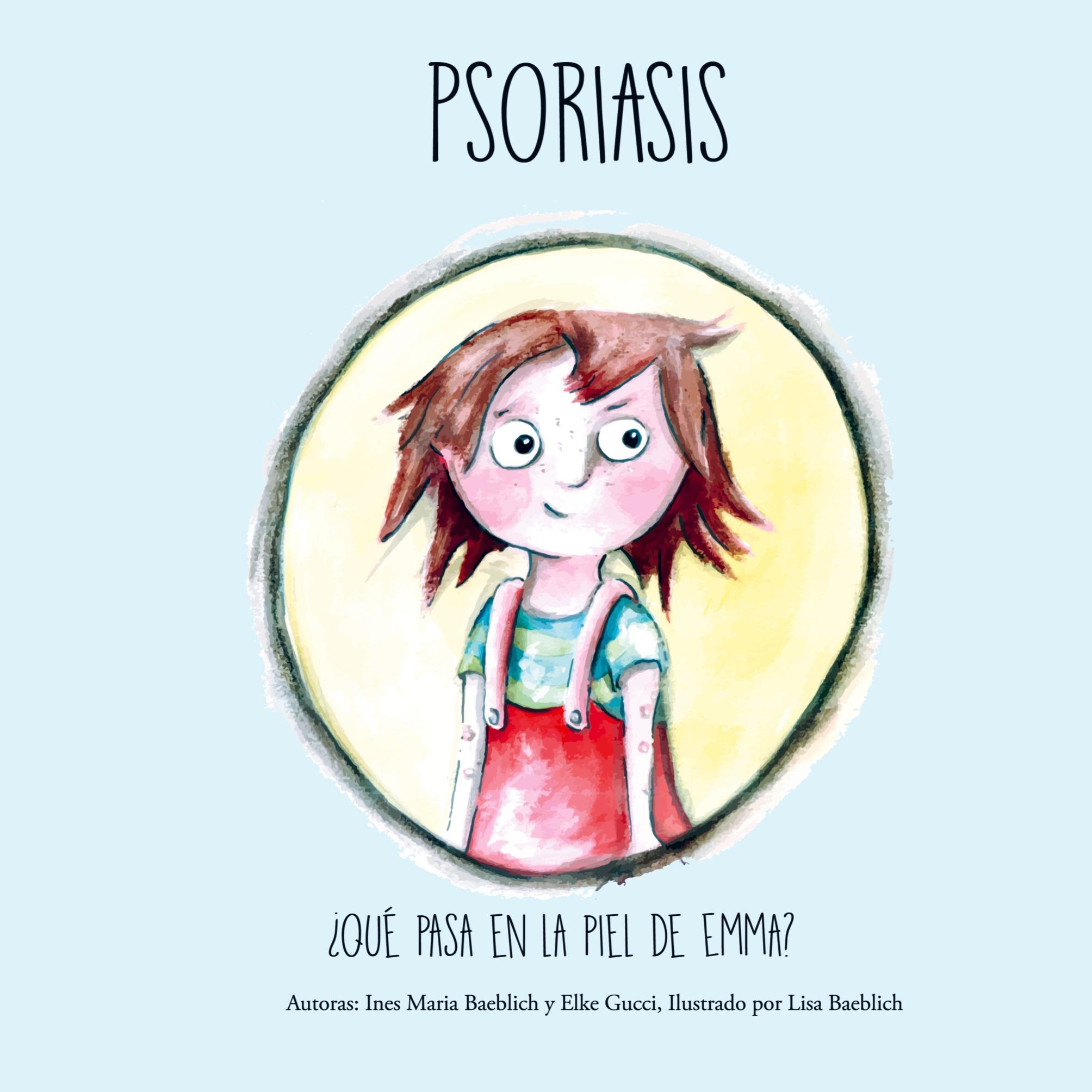 Psoriasis