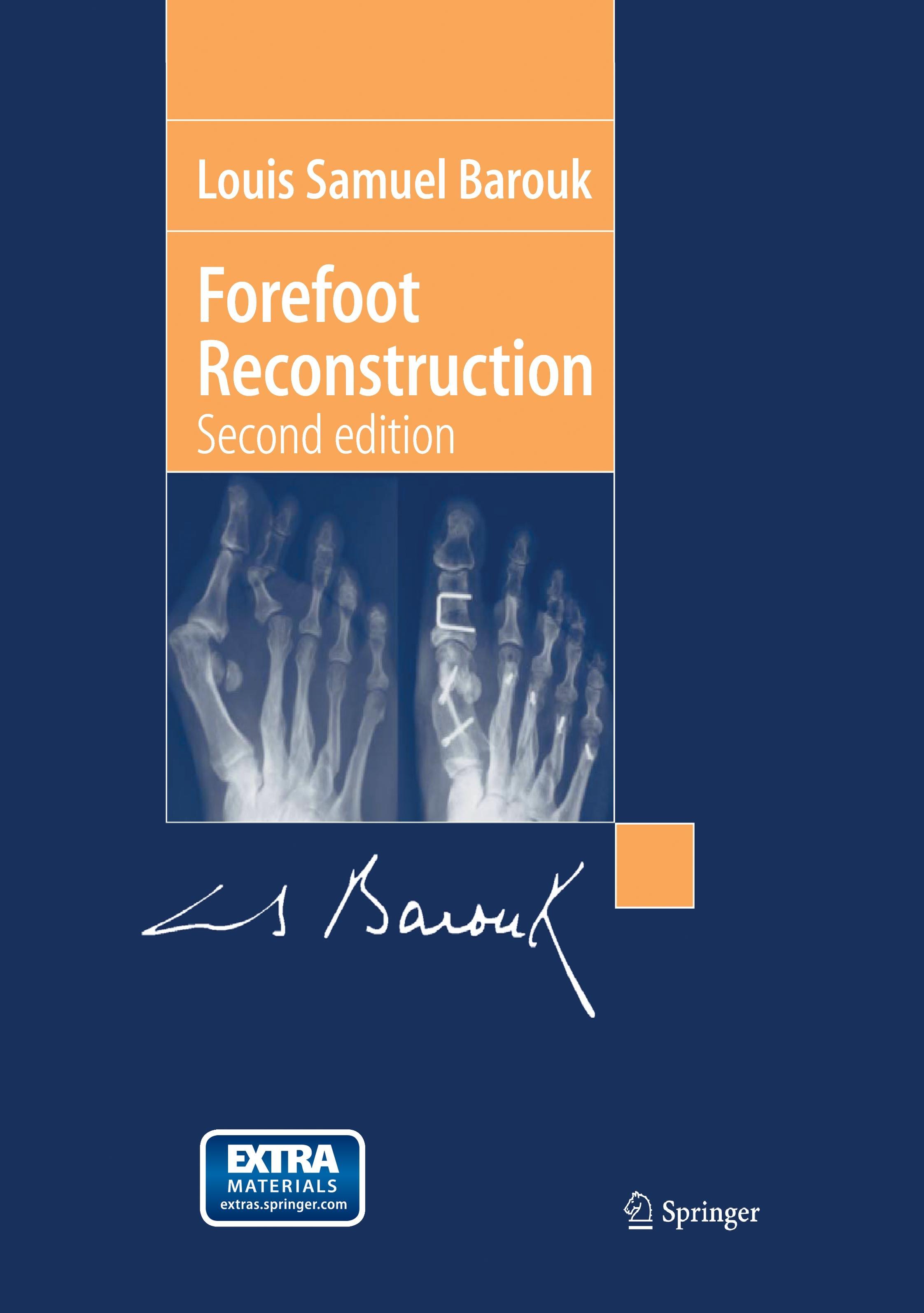 Forefoot Reconstruction