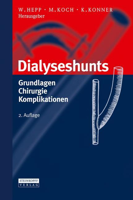 Dialyseshunts