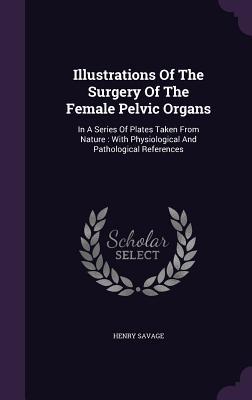 Illustrations Of The Surgery Of The Female Pelvic Organs