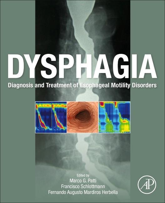 Dysphagia