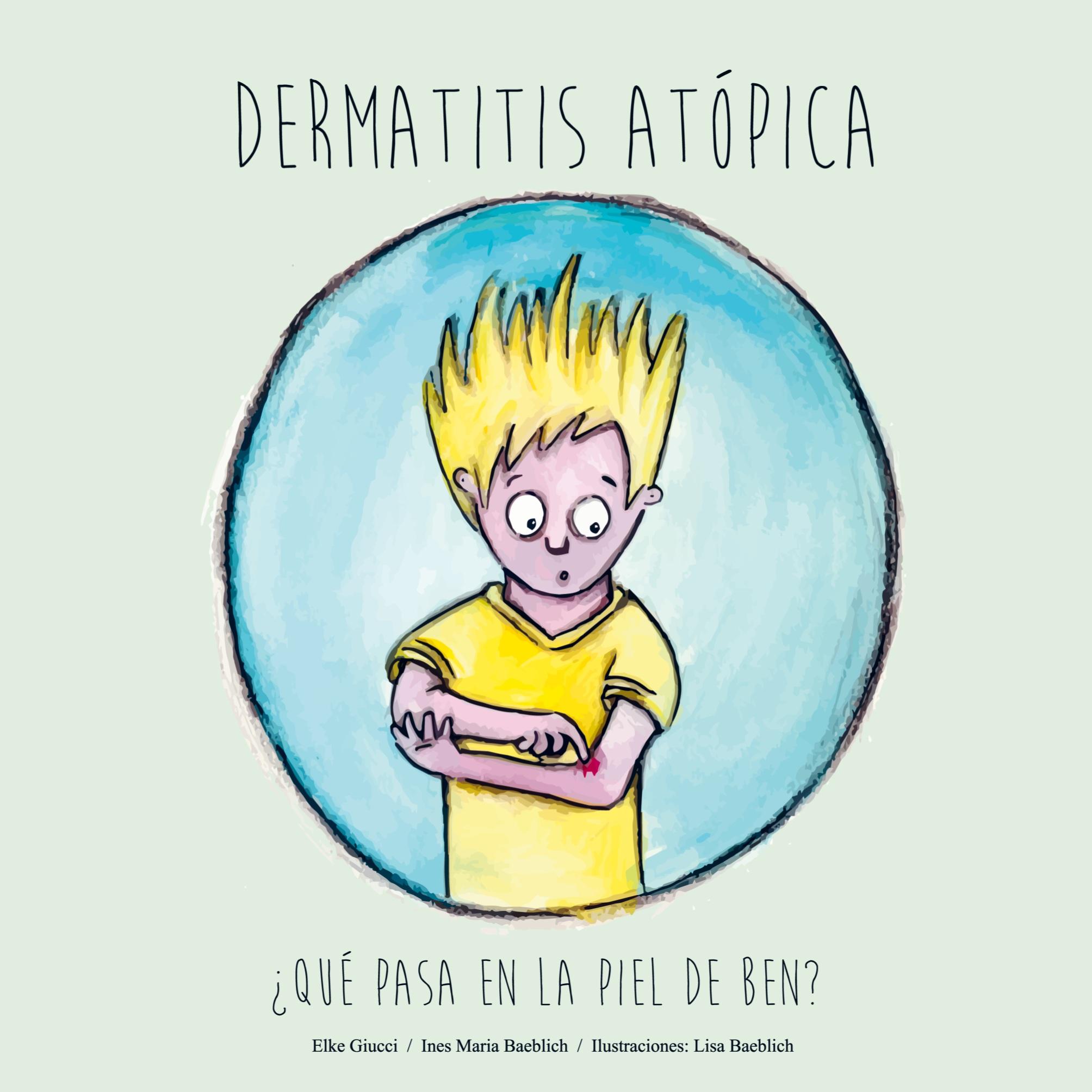 Dermatitis Atópica