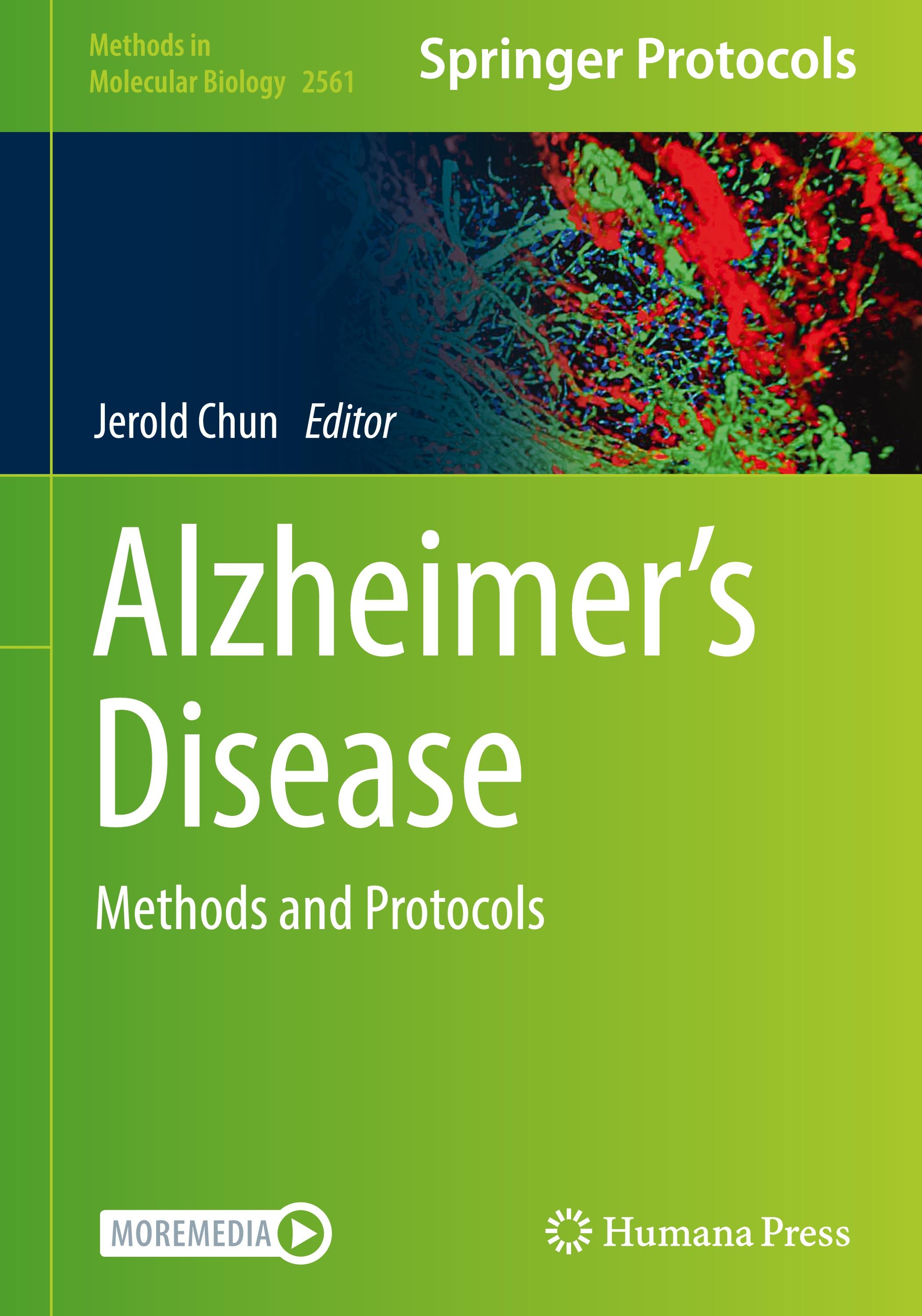 Alzheimer¿s Disease