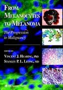 From Melanocytes to Melanoma