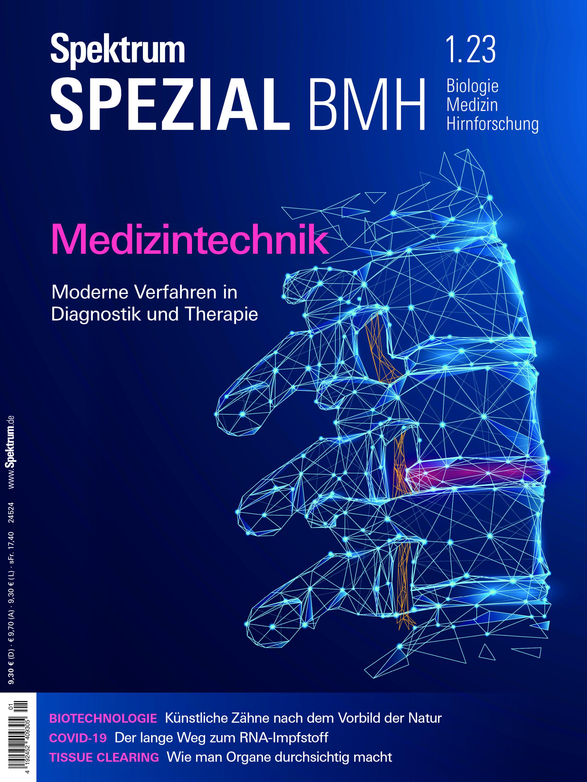 Spektrum Spezial - Medizintechnik