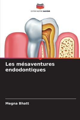 Les mésaventures endodontiques