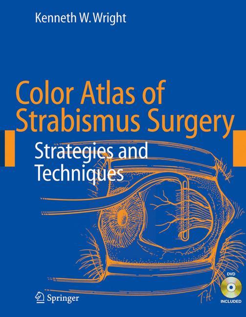 Color Atlas of Strabismus Surgery