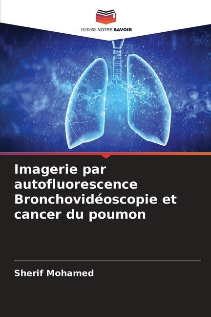 Imagerie par autofluorescence Bronchovidéoscopie et cancer du poumon