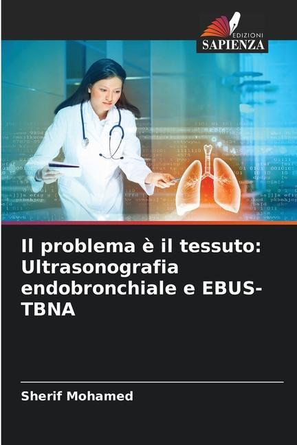 Il problema è il tessuto: Ultrasonografia endobronchiale e EBUS-TBNA