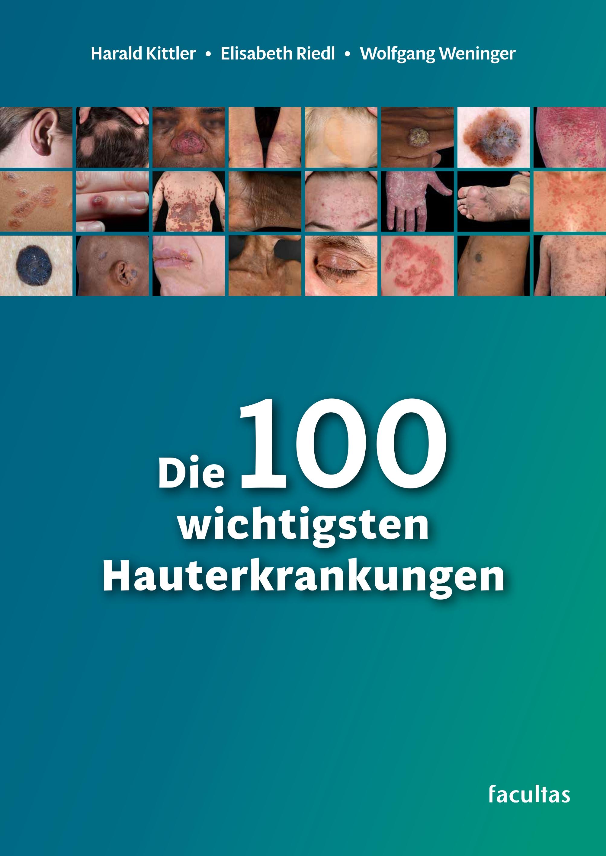 Die 100 wichtigsten Hauterkrankungen