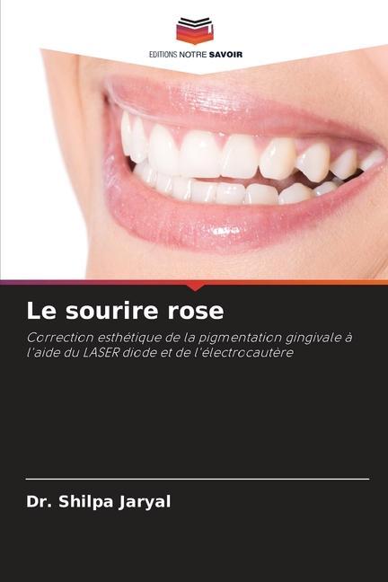 Le sourire rose