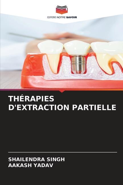 THÉRAPIES D'EXTRACTION PARTIELLE