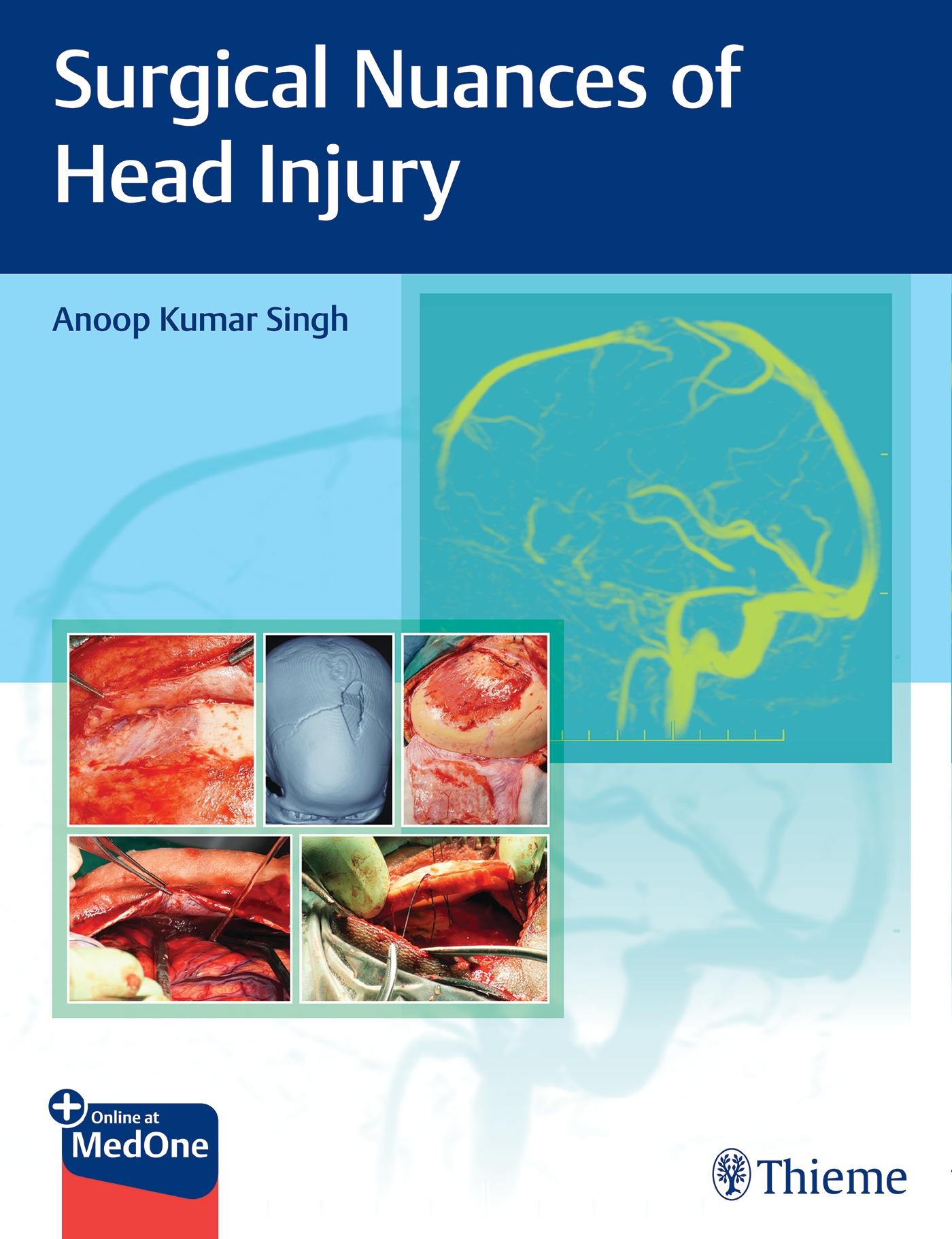 Surgical Nuances of Head Injury