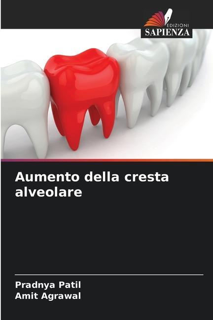 Aumento della cresta alveolare