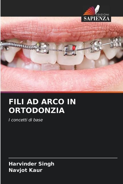 FILI AD ARCO IN ORTODONZIA