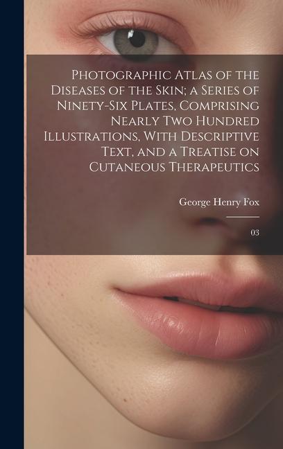 Photographic Atlas of the Diseases of the Skin; a Series of Ninety-six Plates, Comprising Nearly two Hundred Illustrations, With Descriptive Text, and