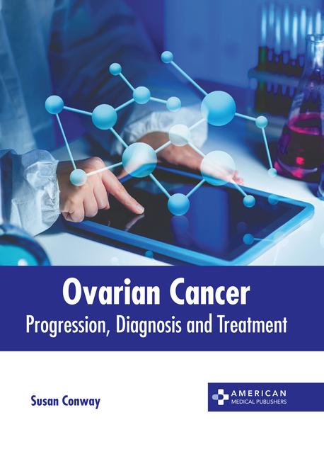 Ovarian Cancer: Progression, Diagnosis and Treatment