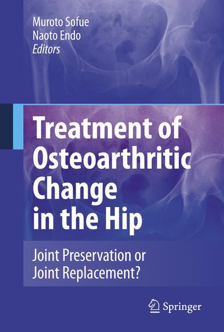 Treatment of Osteoarthritic Change in the Hip