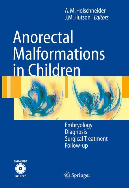 Anorectal Malformations in Children