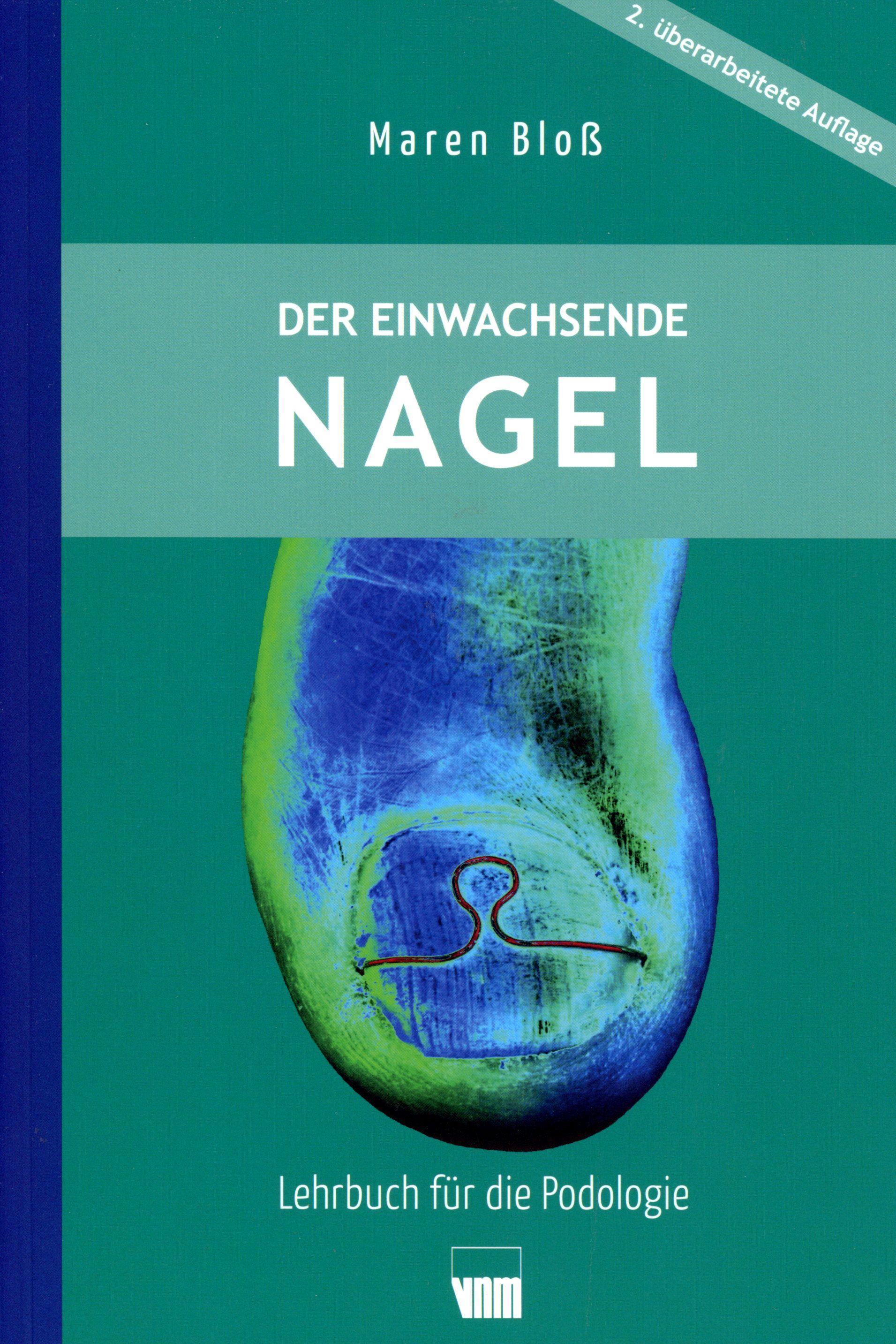 Der eingewachsenen Nagel