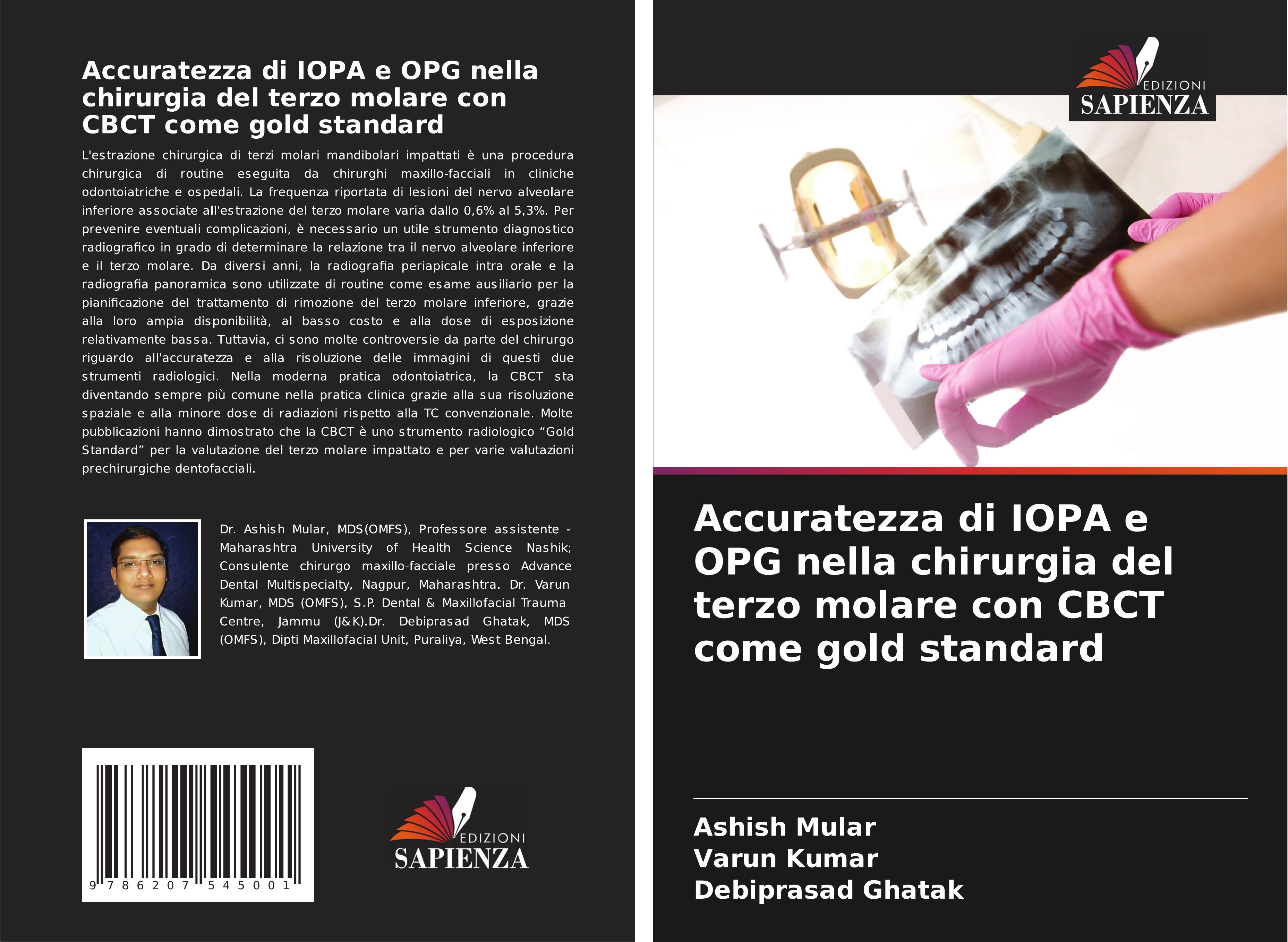 Accuratezza di IOPA e OPG nella chirurgia del terzo molare con CBCT come gold standard