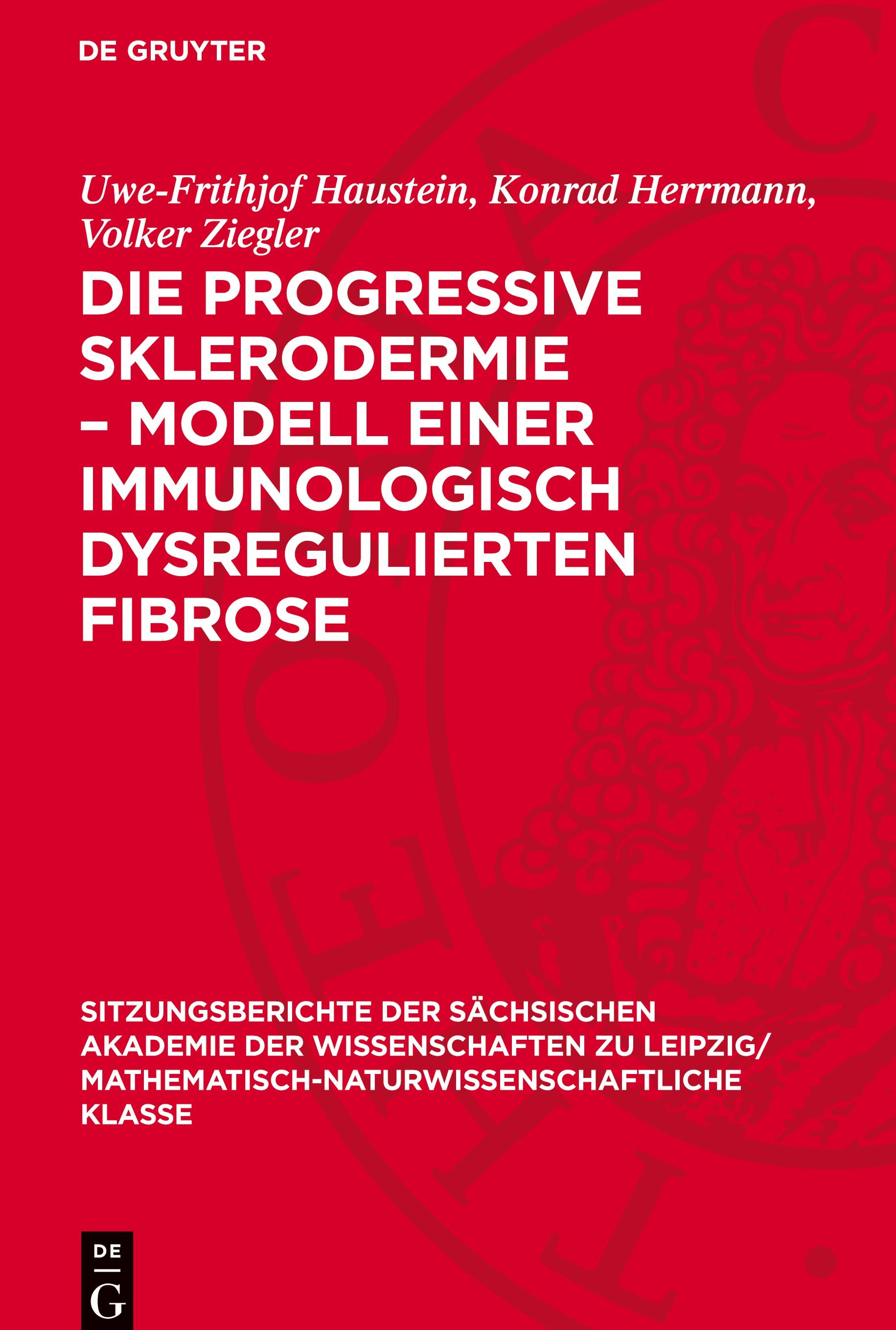 Die progressive Sklerodermie ¿ Modell einer immunologisch dysregulierten Fibrose