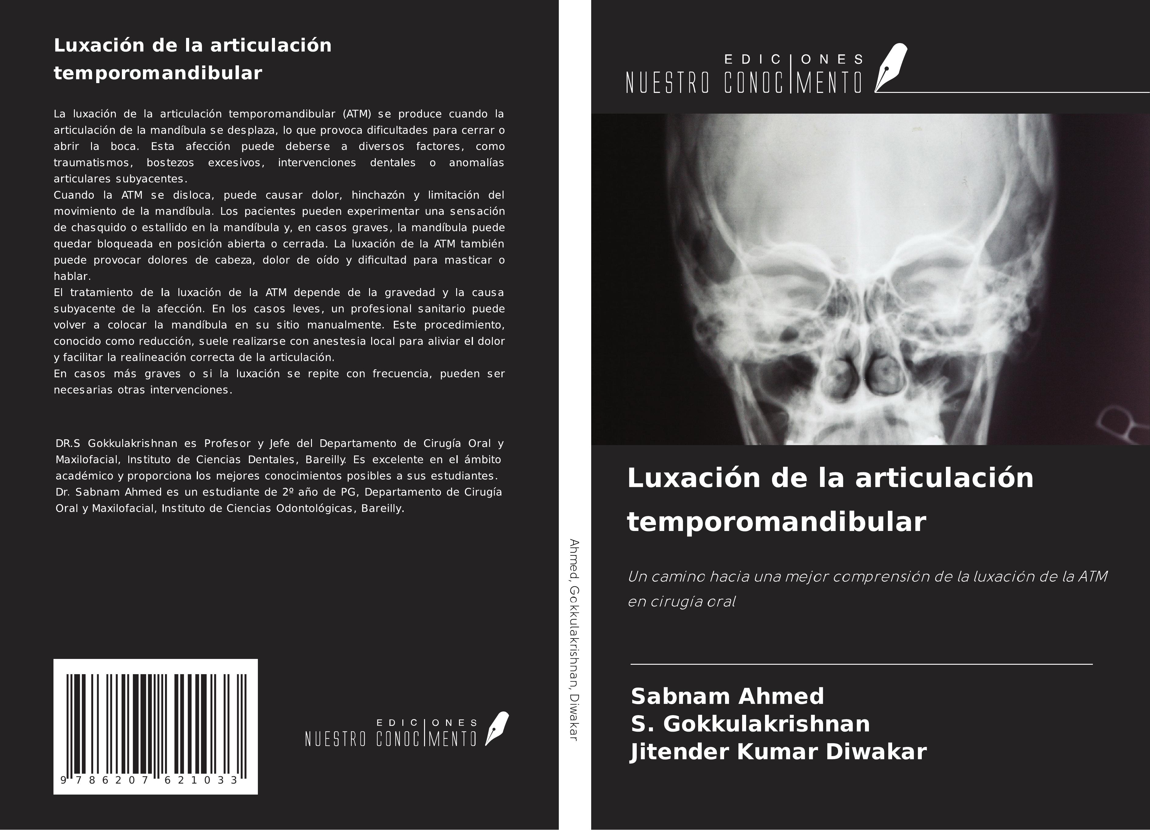 Luxación de la articulación temporomandibular