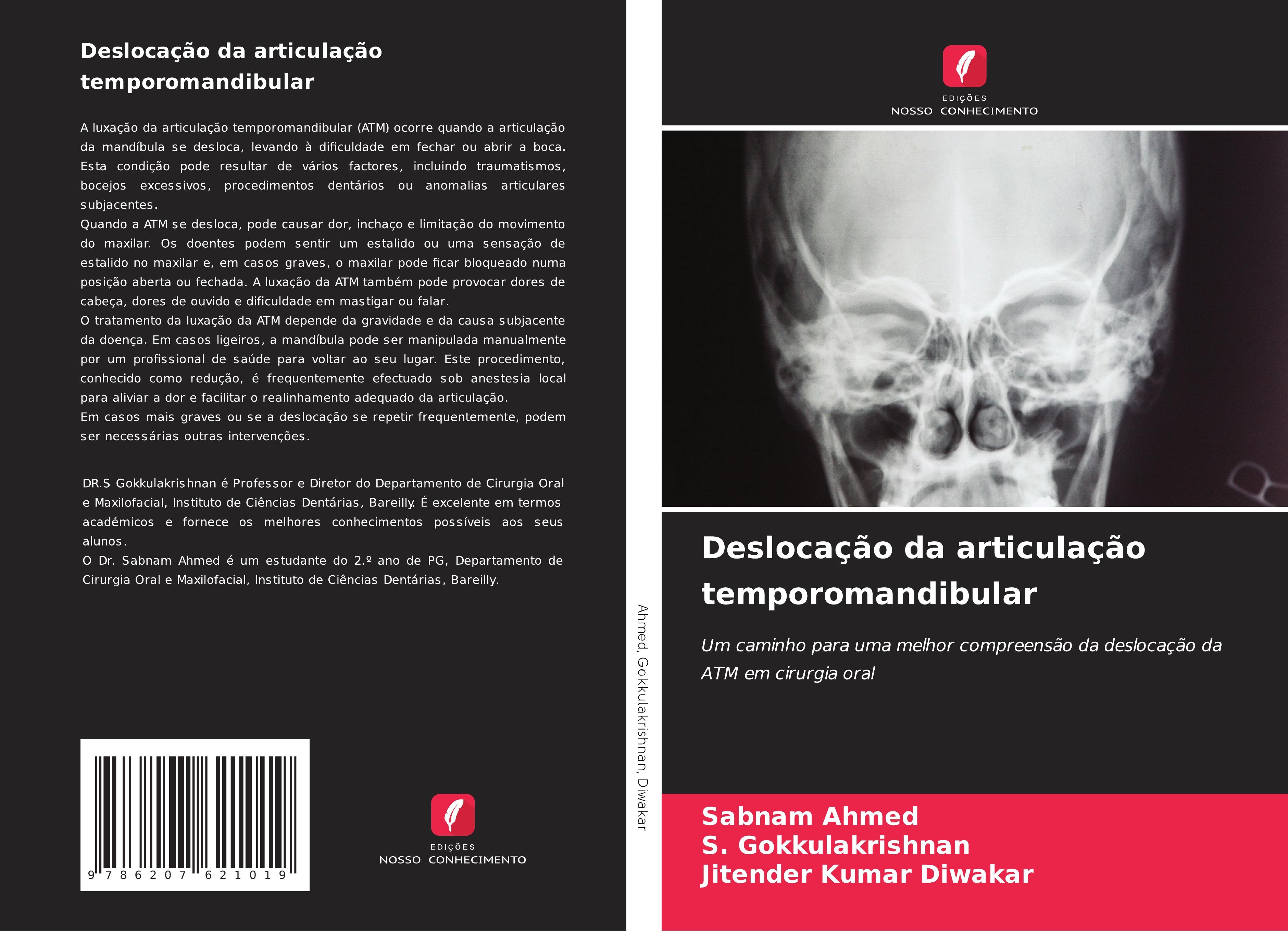 Deslocação da articulação temporomandibular