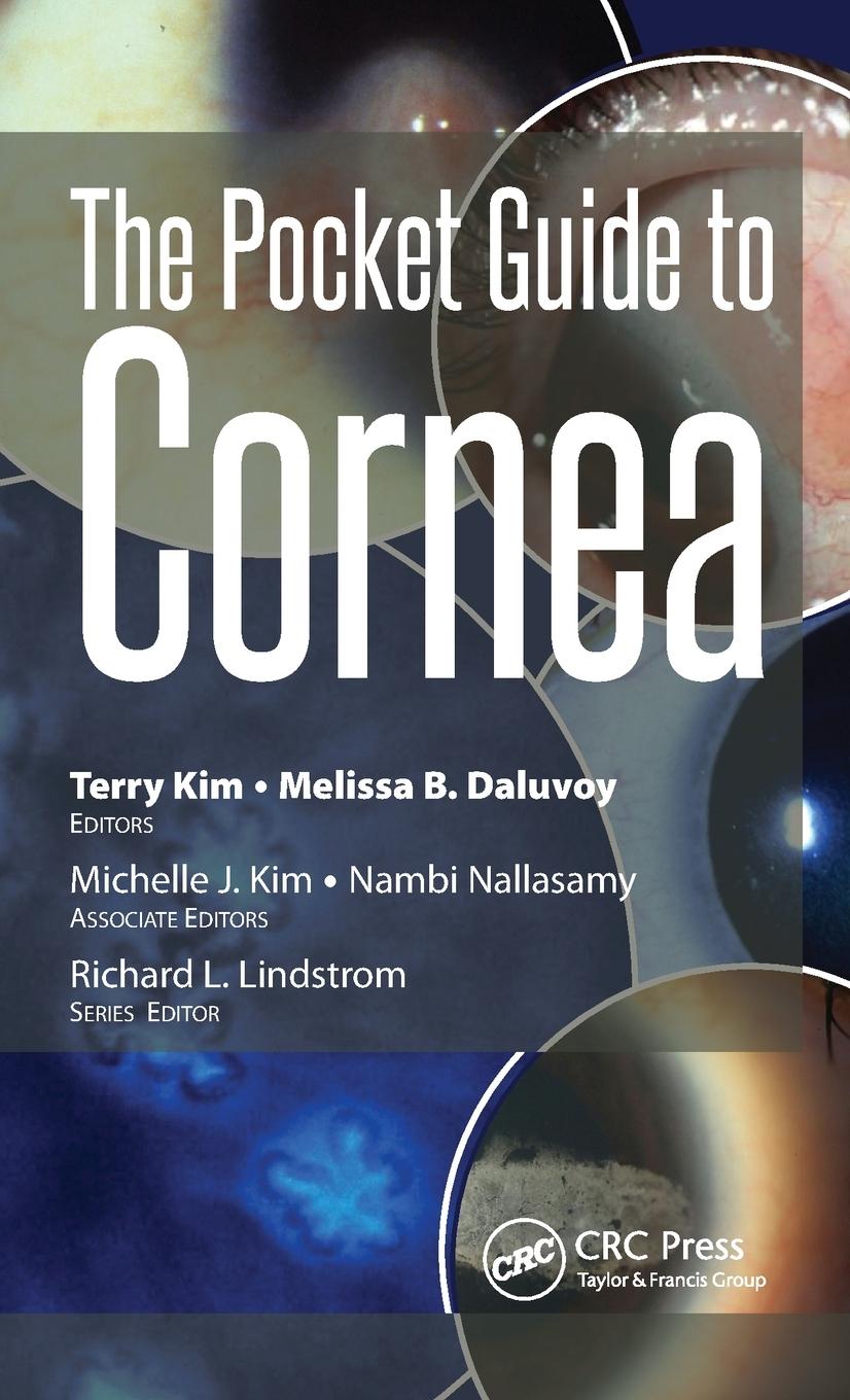 The Pocket Guide to Cornea