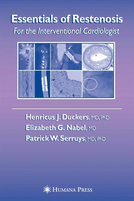 Essentials of Restenosis