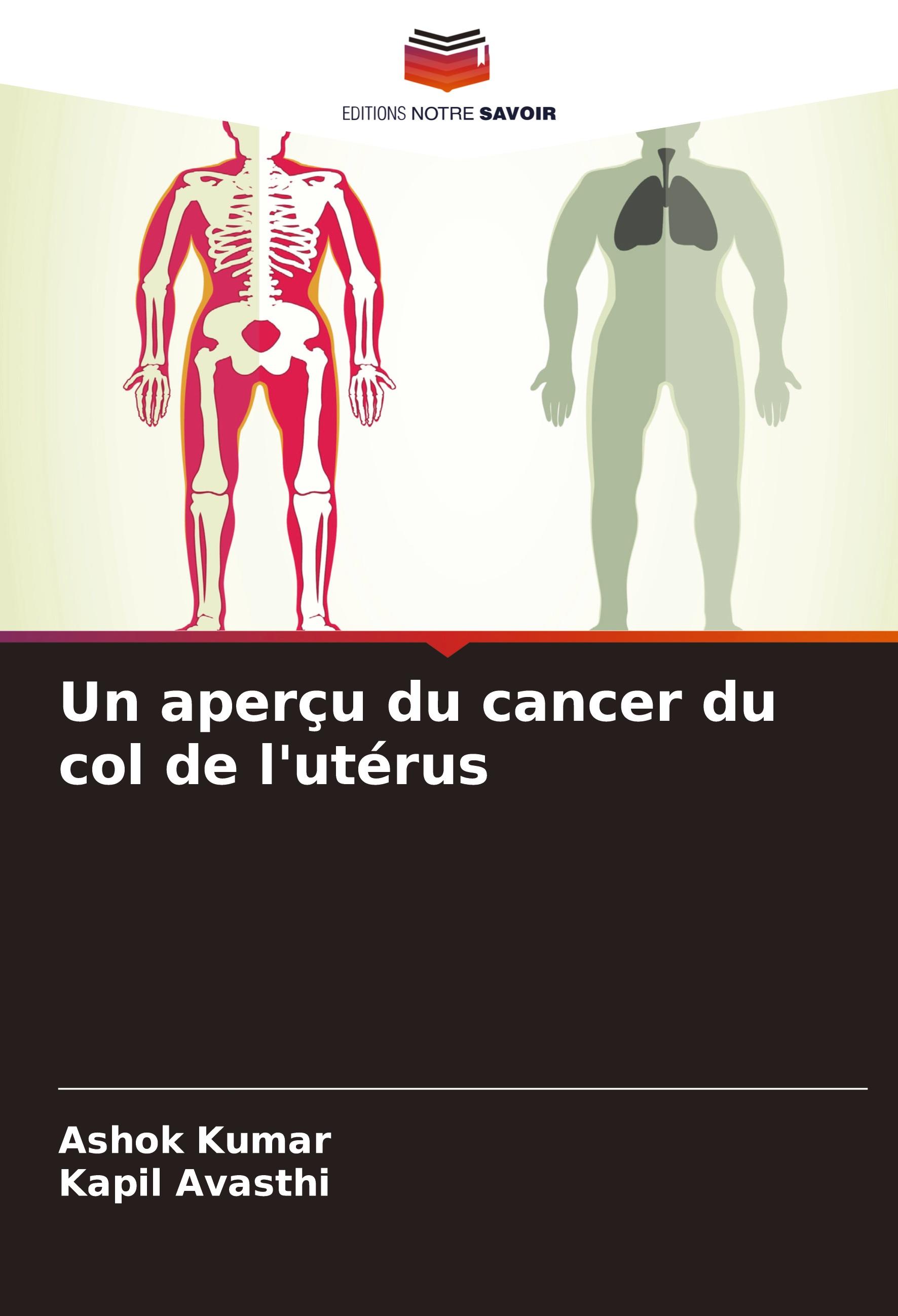 Un aperçu du cancer du col de l'utérus