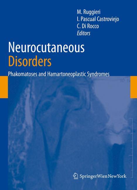 Neurocutaneous Disorders