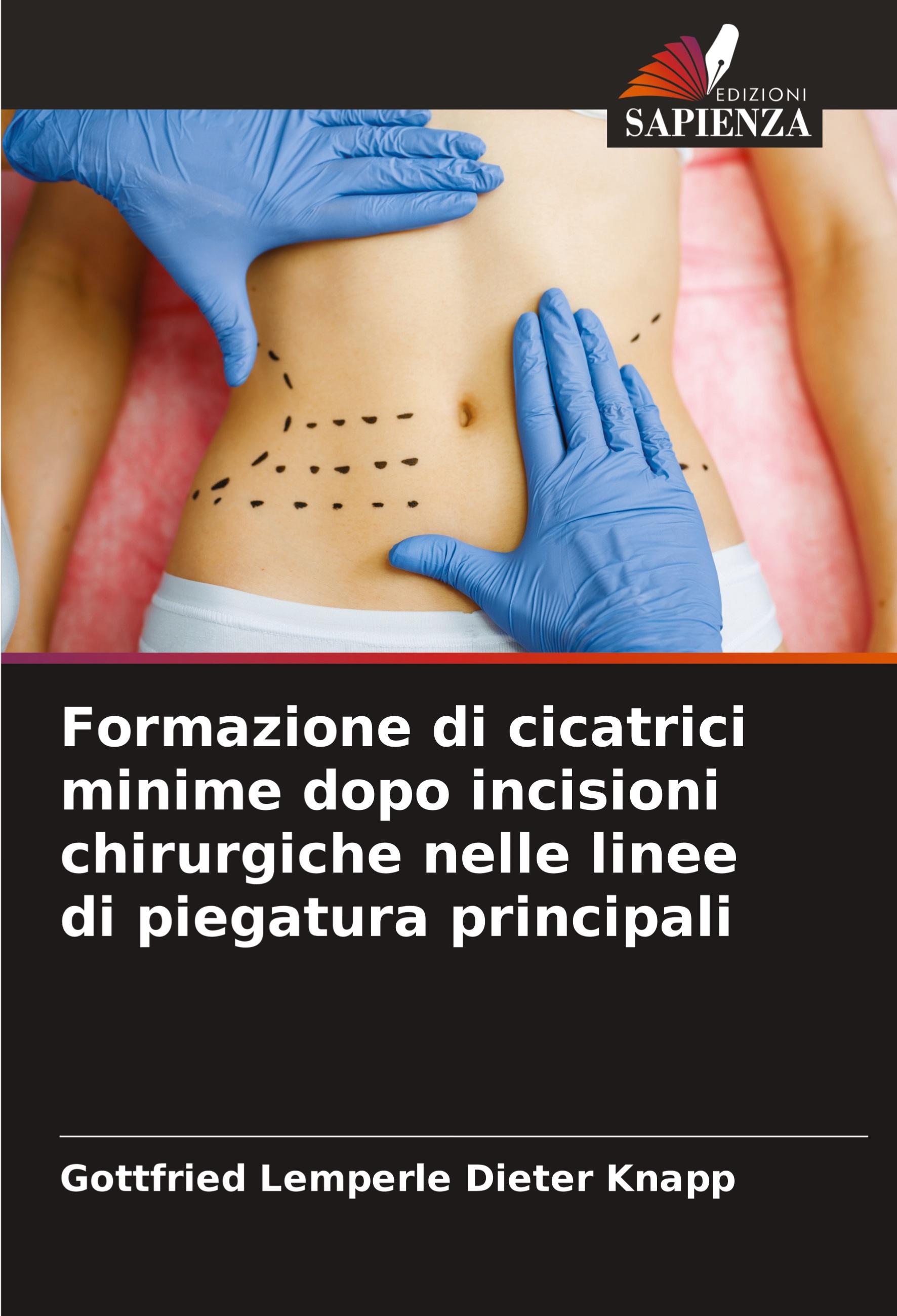 Formazione di cicatrici minime dopo incisioni chirurgiche nelle linee di piegatura principali