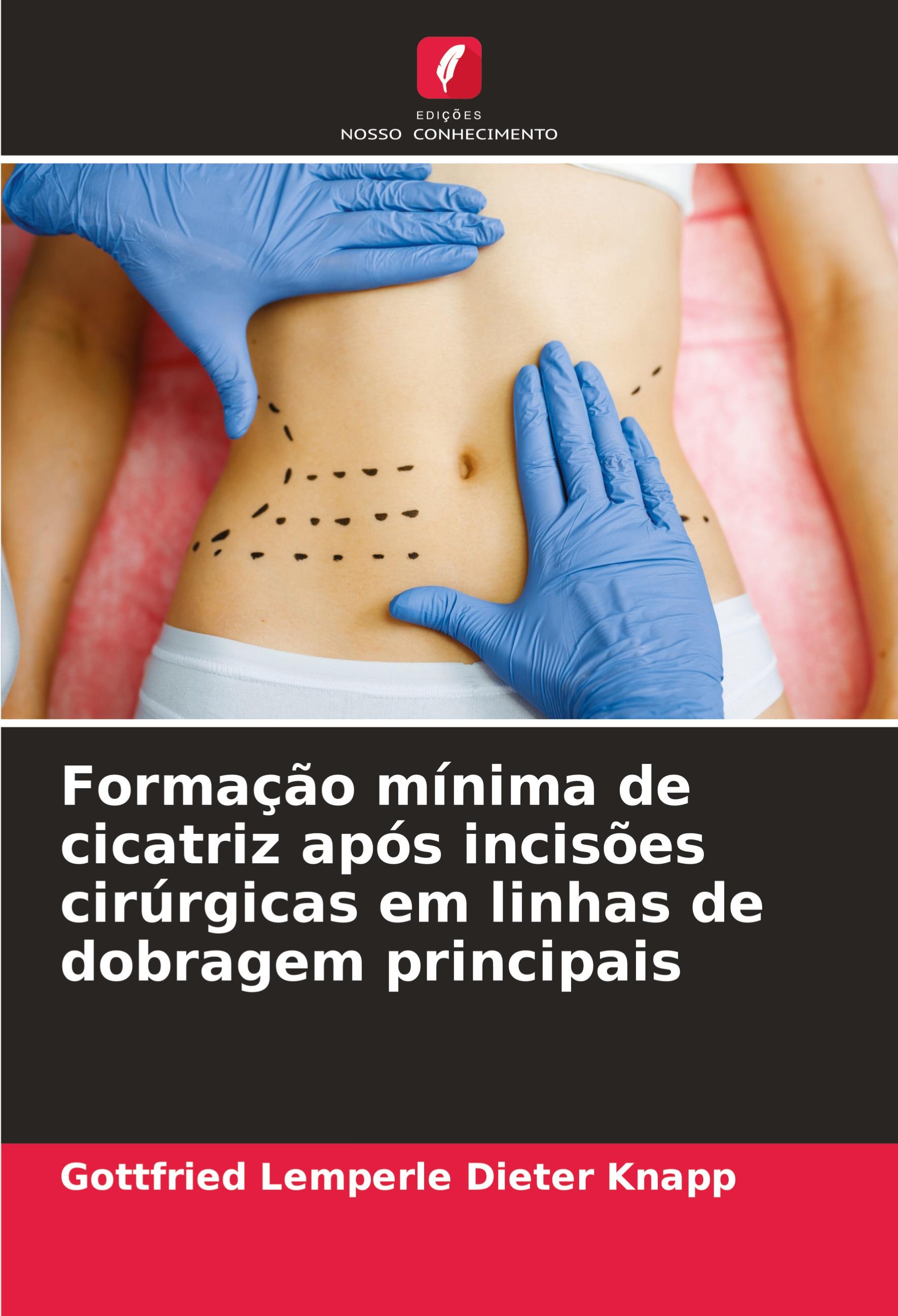 Formação mínima de cicatriz após incisões cirúrgicas em linhas de dobragem principais