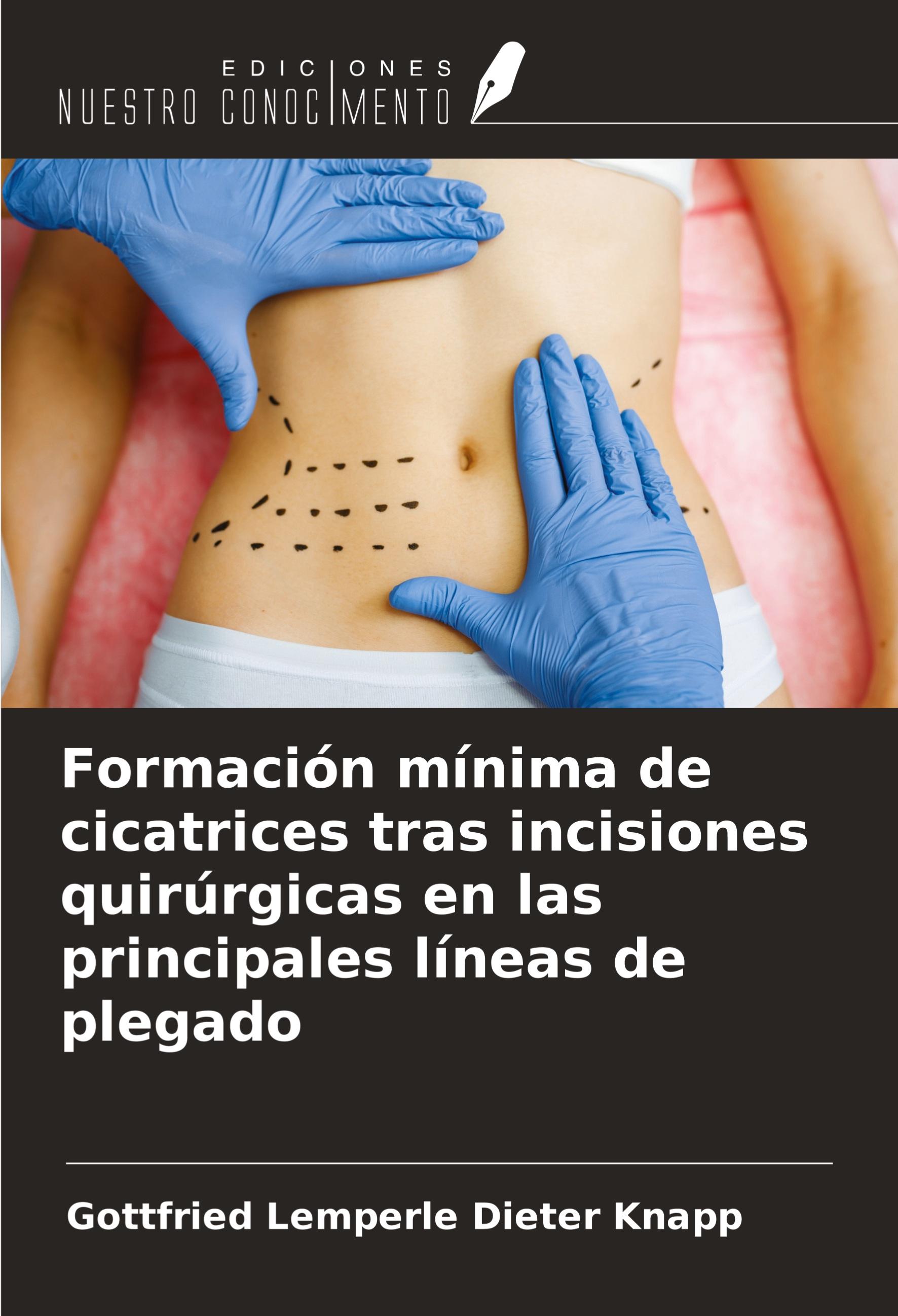 Formación mínima de cicatrices tras incisiones quirúrgicas en las principales líneas de plegado