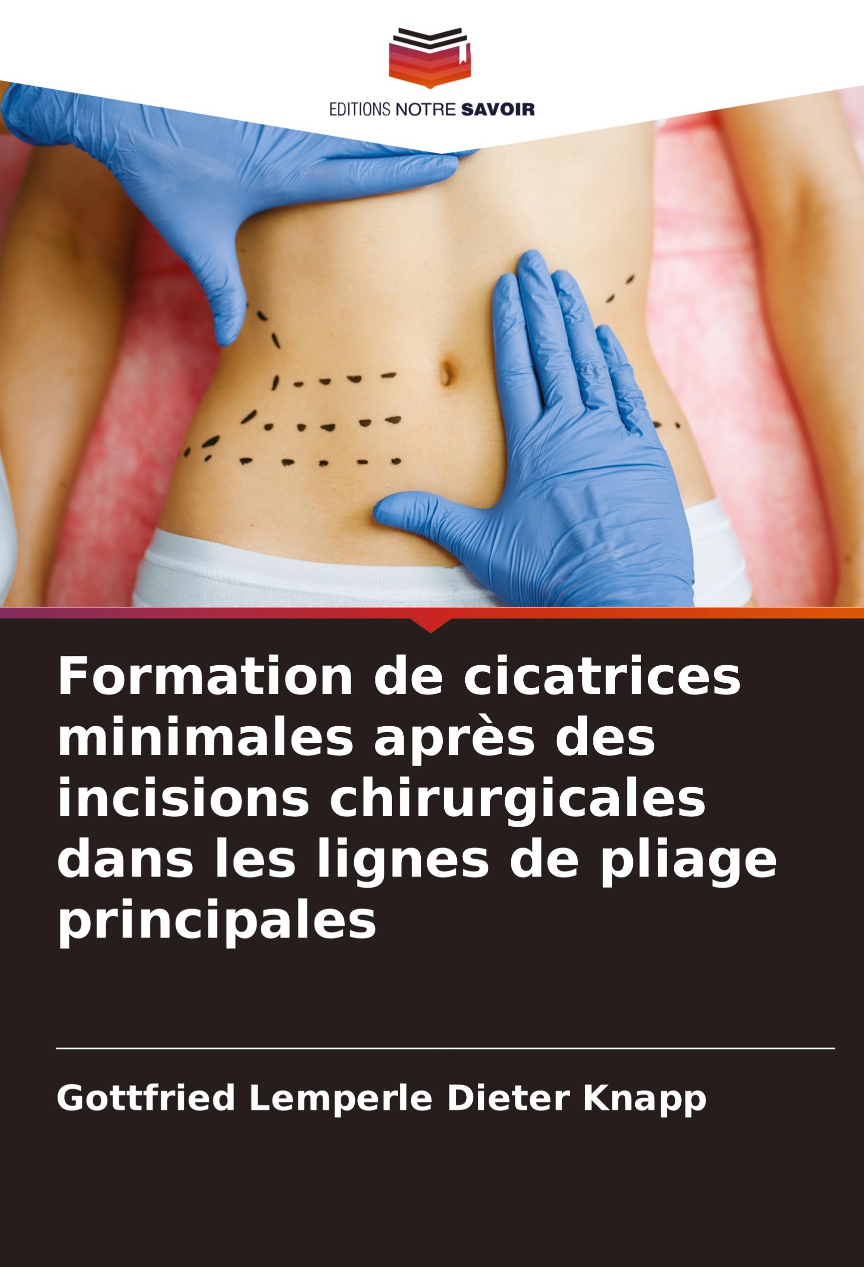 Formation de cicatrices minimales après des incisions chirurgicales dans les lignes de pliage principales