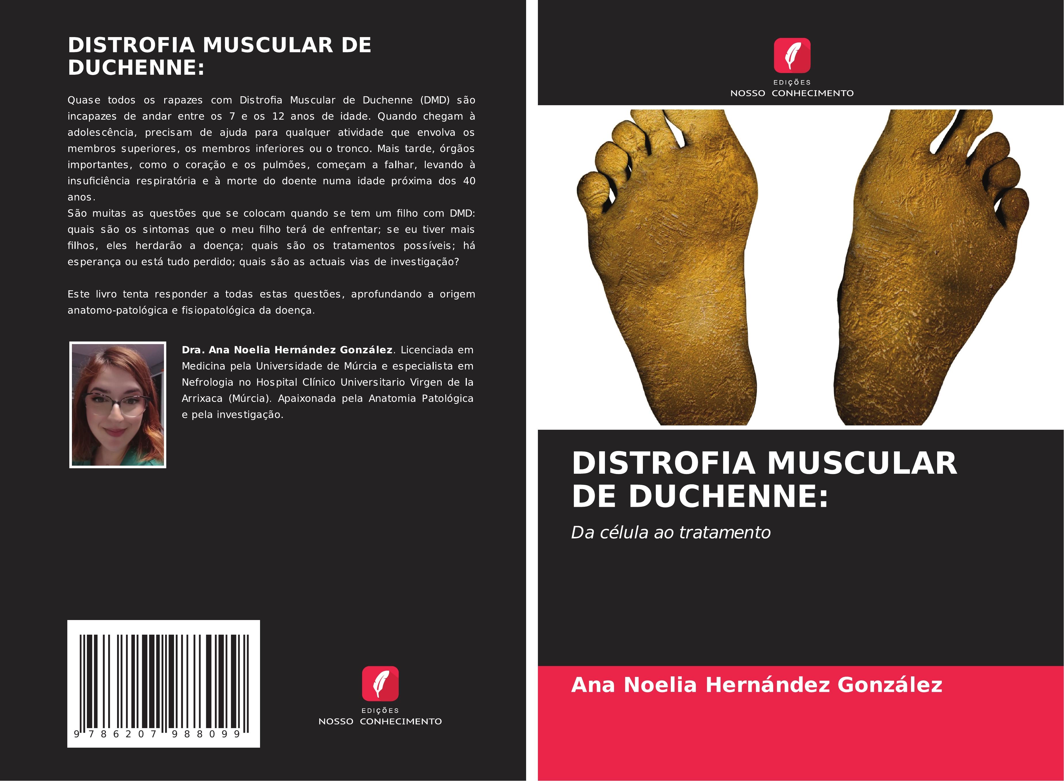 DISTROFIA MUSCULAR DE DUCHENNE: