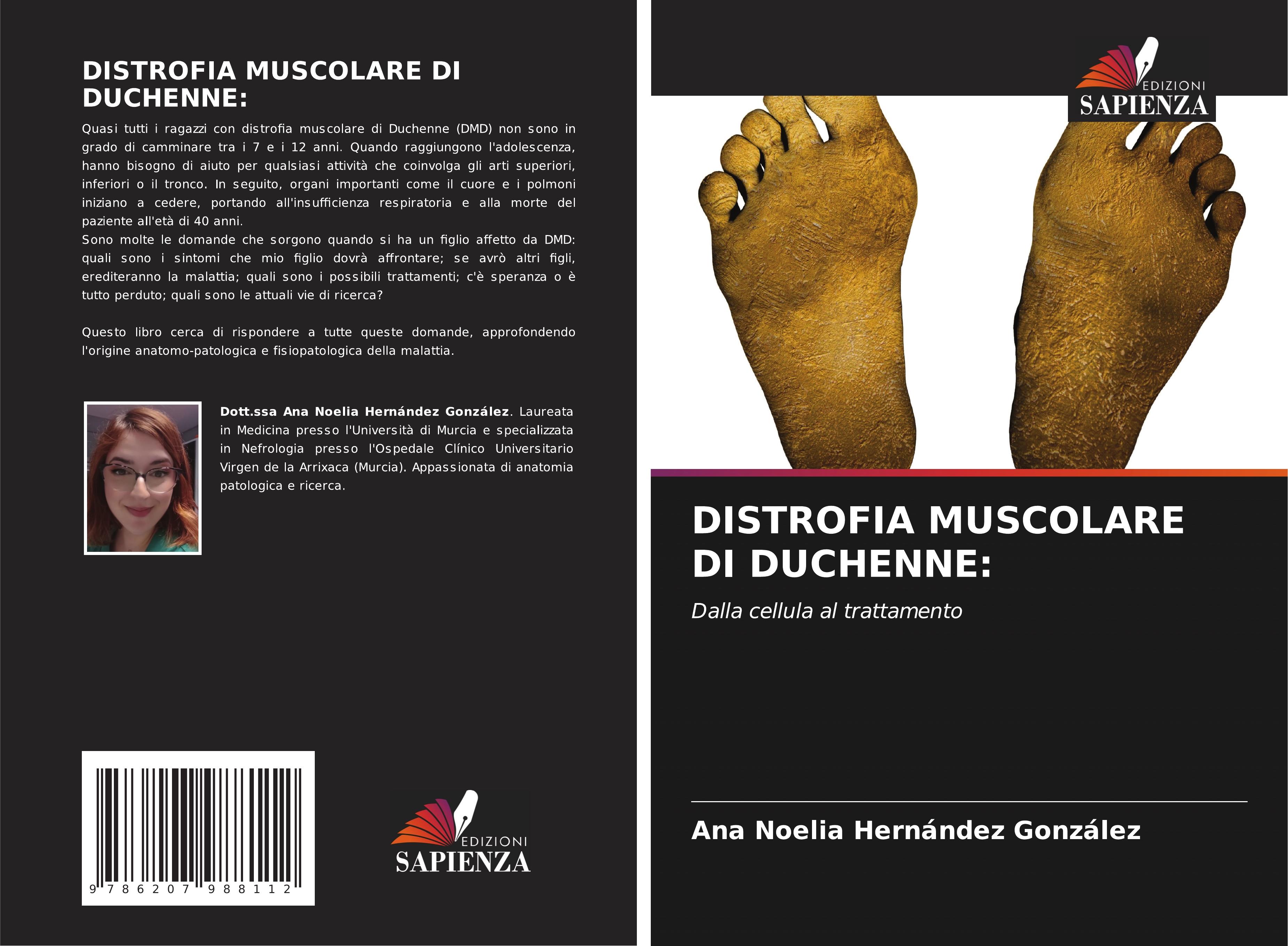 DISTROFIA MUSCOLARE DI DUCHENNE: