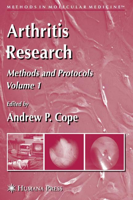 Arthritis Research