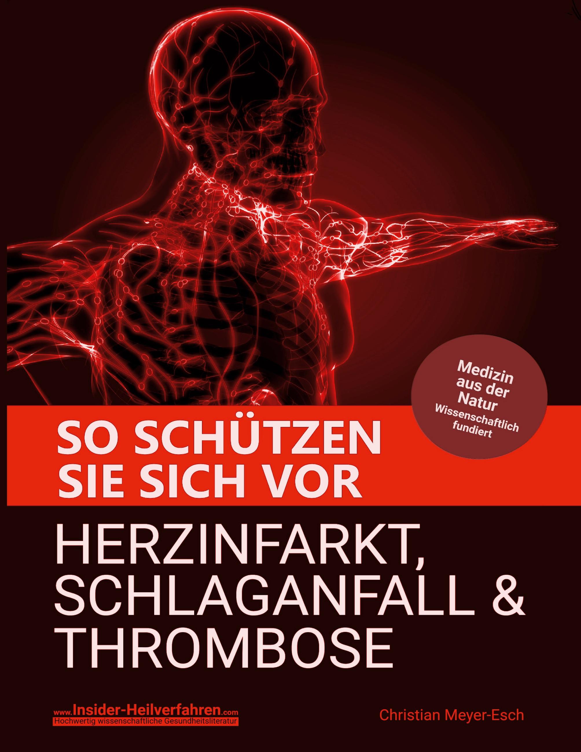 So schützen Sie sich vor Herzinfarkt, Schlaganfall und Thrombose