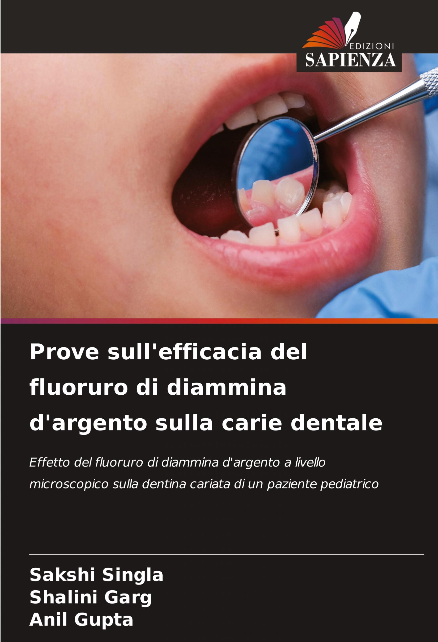 Prove sull'efficacia del fluoruro di diammina d'argento sulla carie dentale