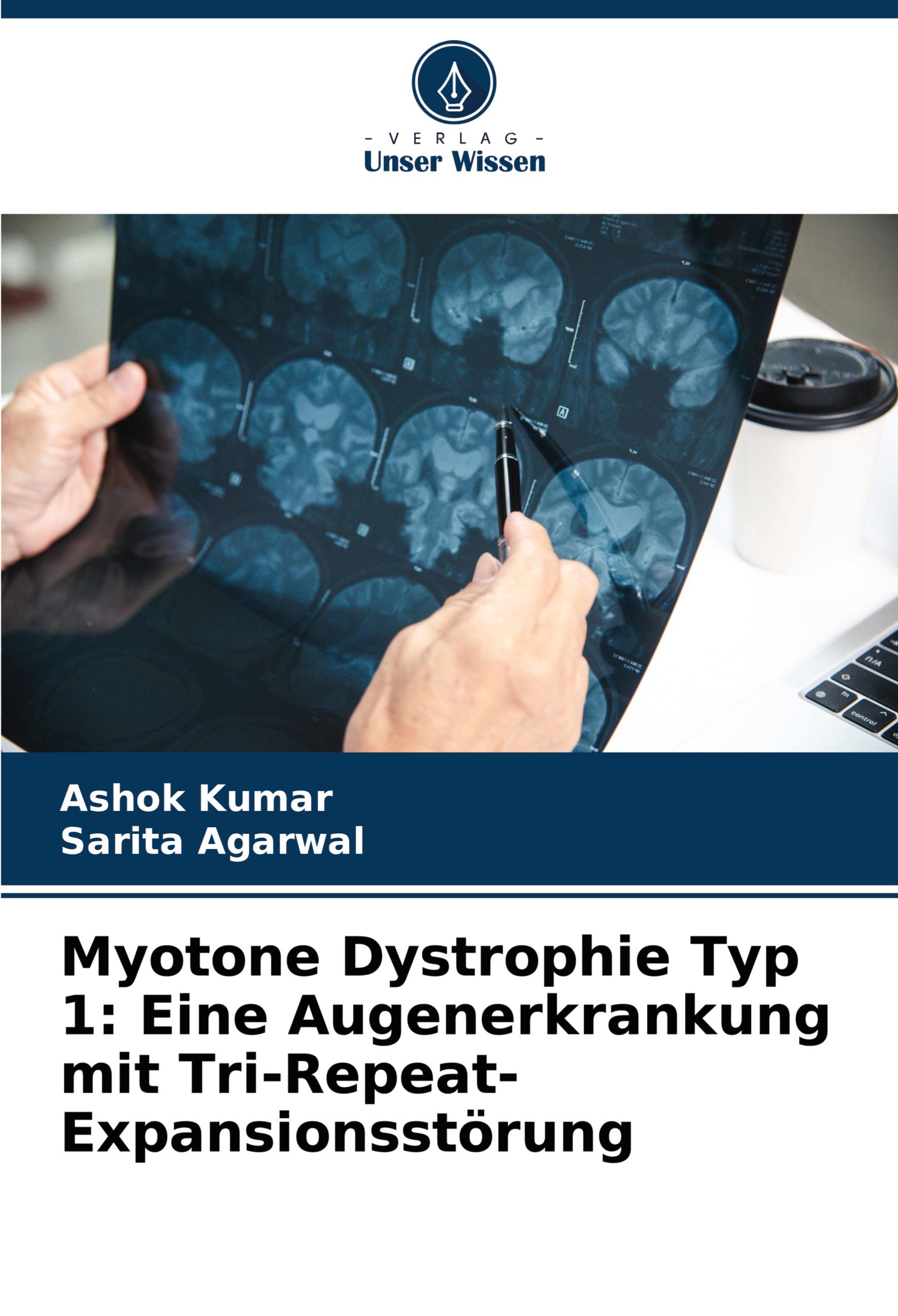 Myotone Dystrophie Typ 1: Eine Augenerkrankung mit Tri-Repeat-Expansionsstörung