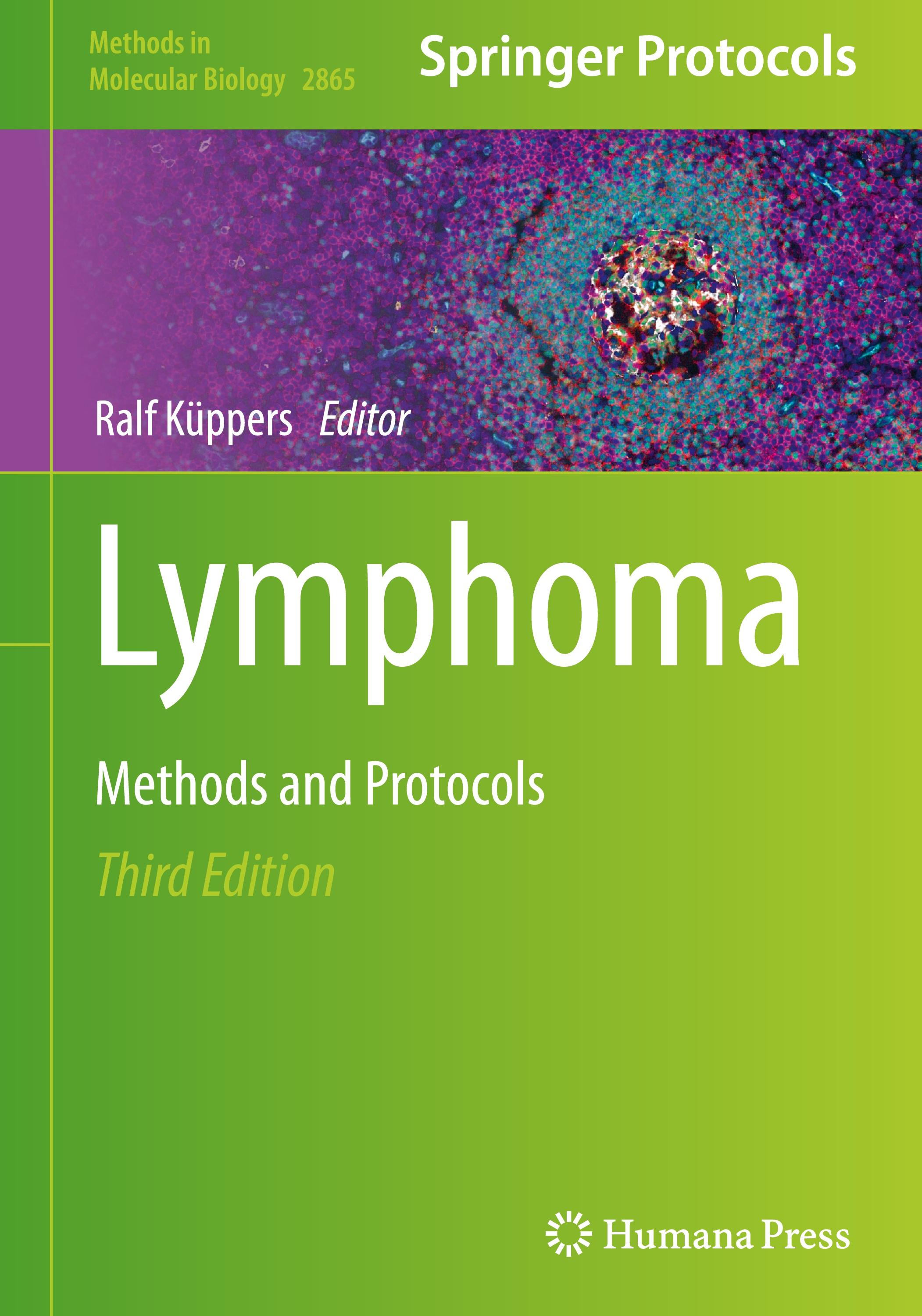 Lymphoma