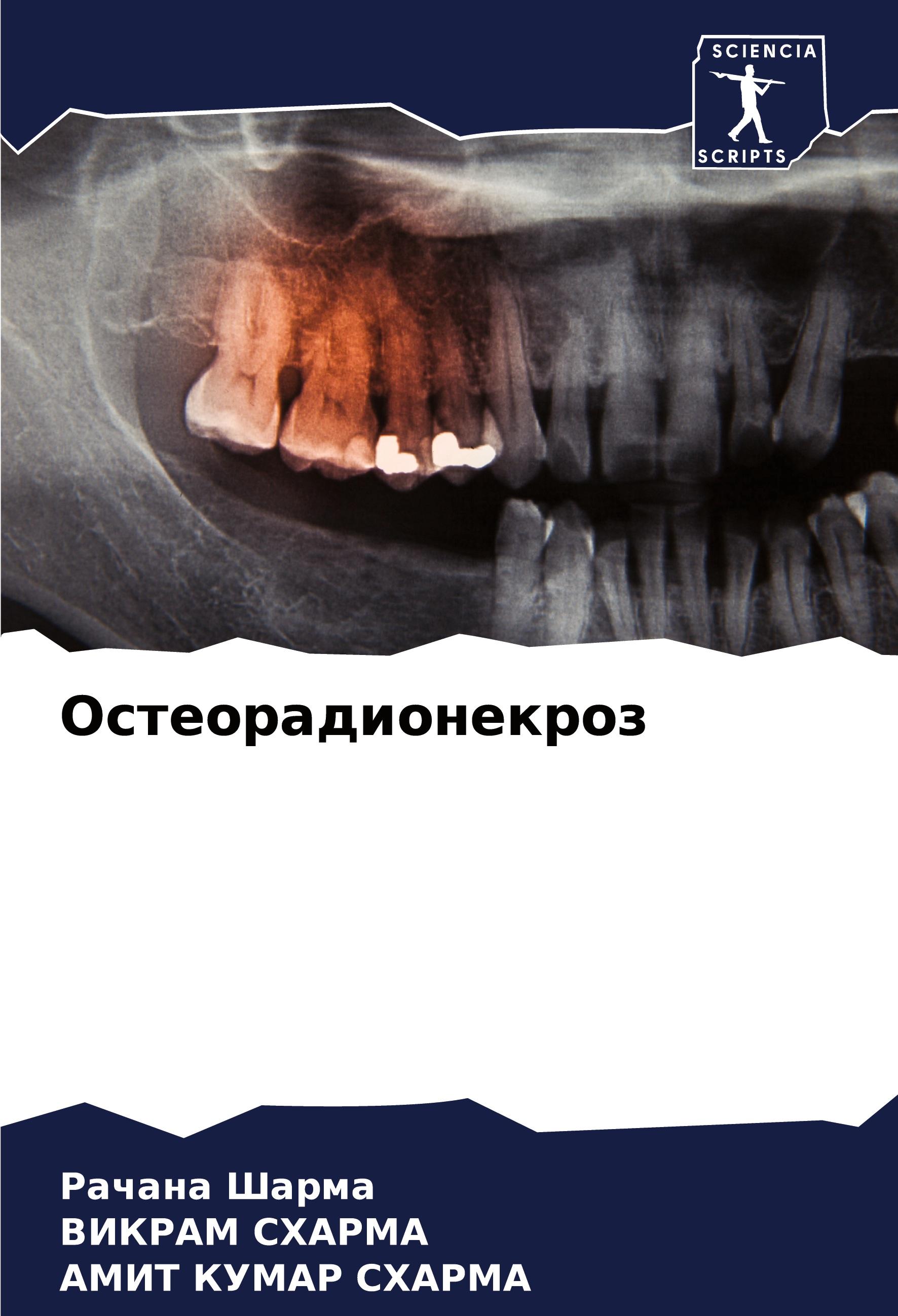 Osteoradionekroz