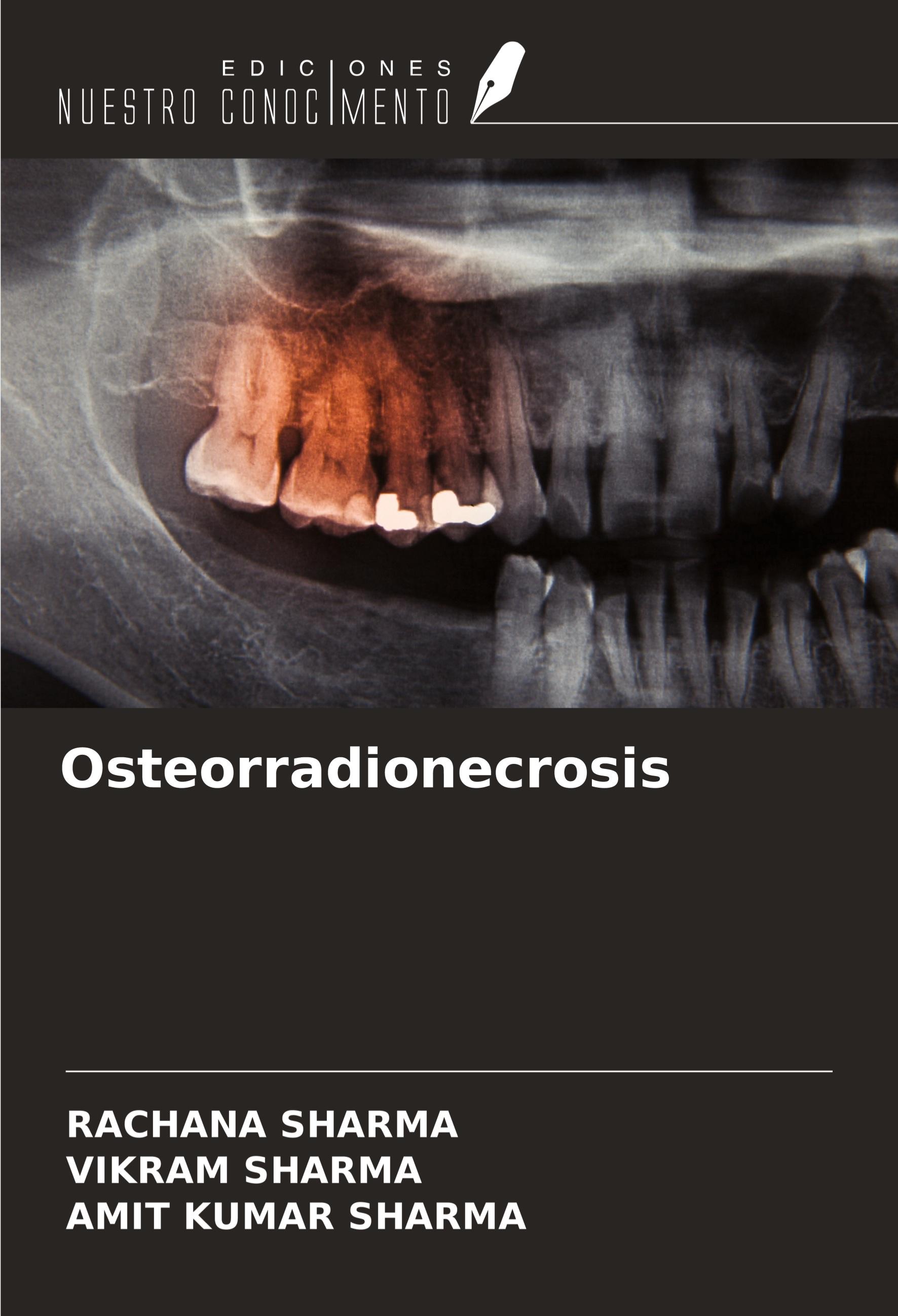 Osteorradionecrosis