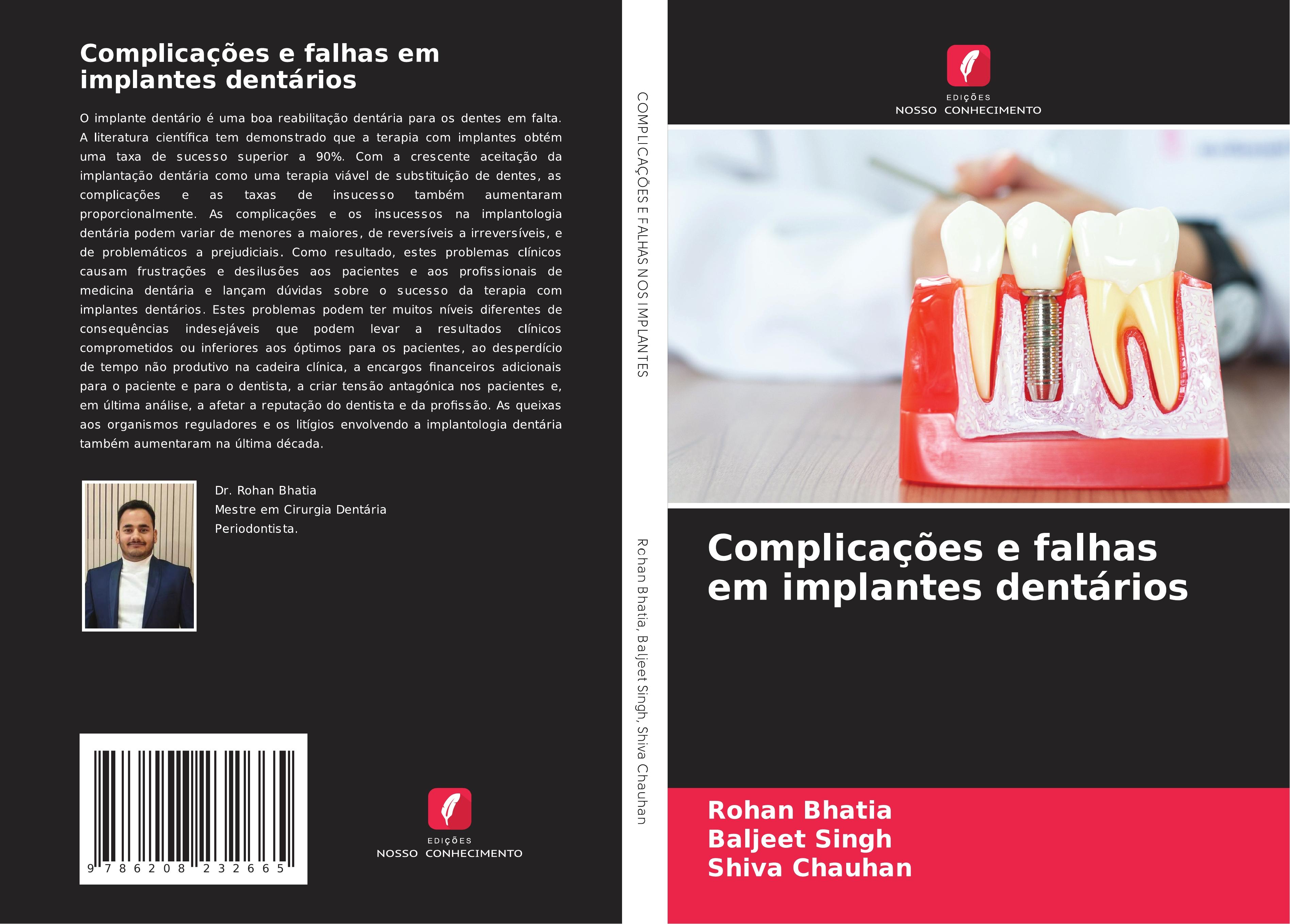 Complicações e falhas em implantes dentários