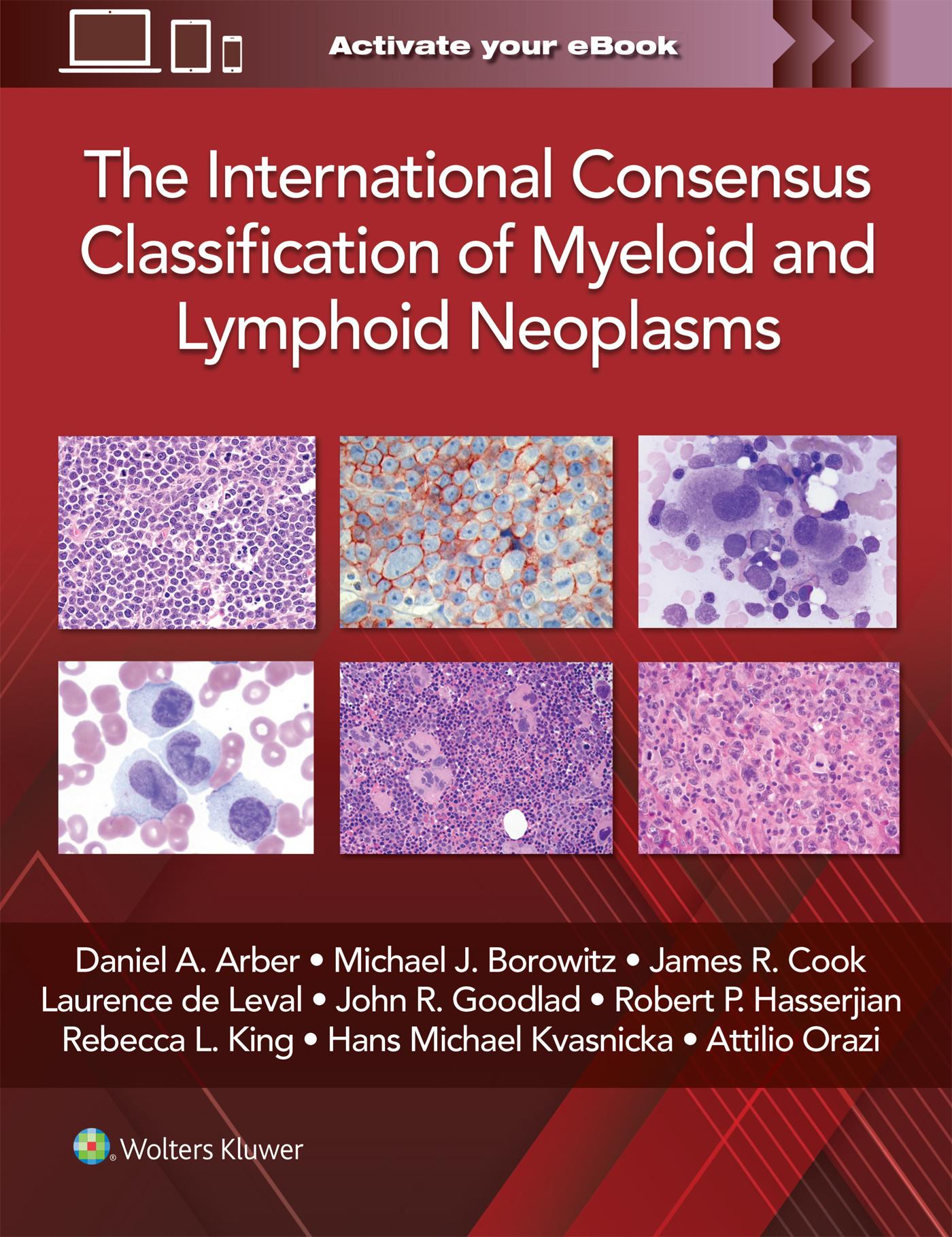 The International Consensus Classification of Myeloid and Lymphoid Neoplasms