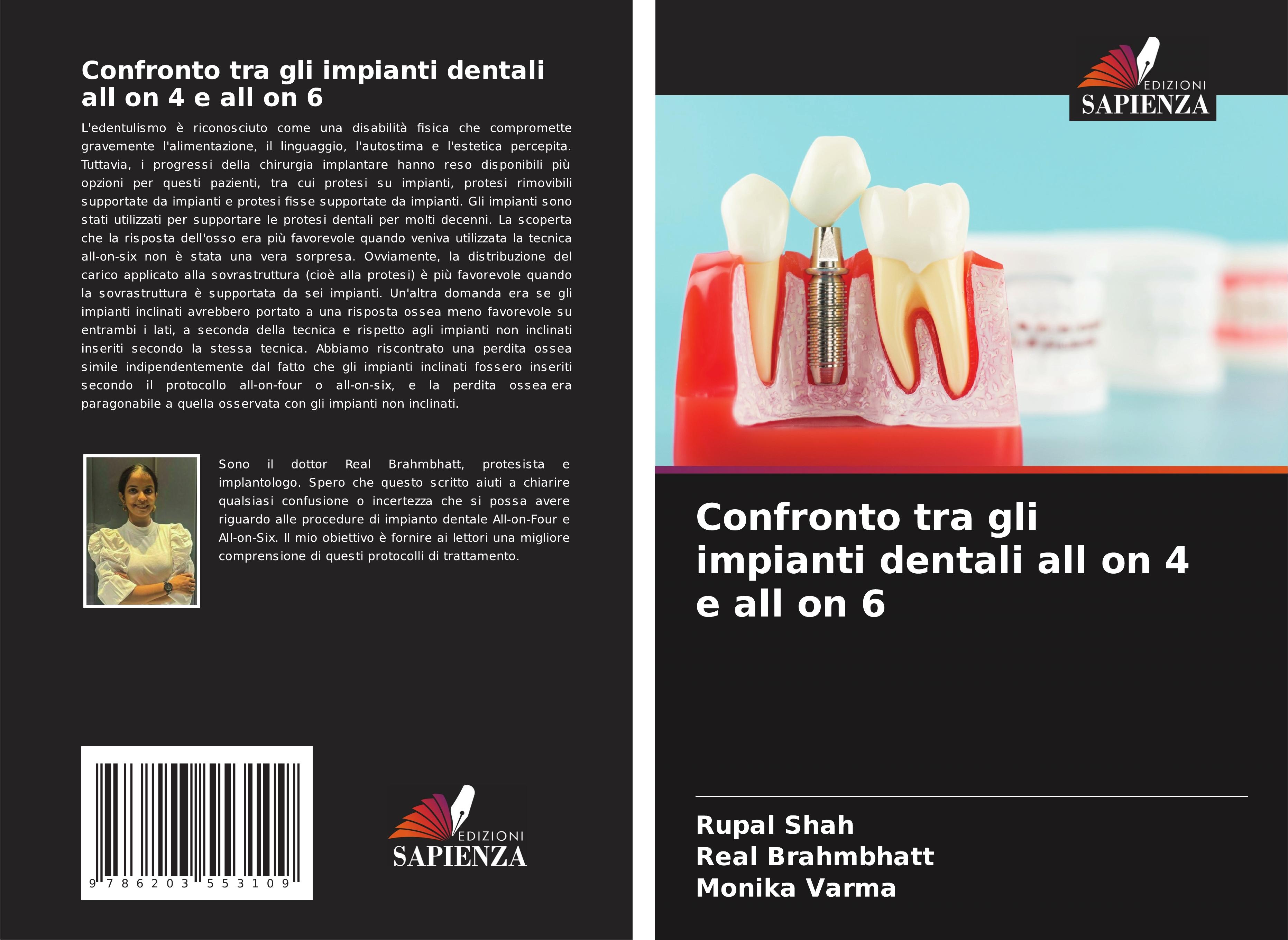 Confronto tra gli impianti dentali all on 4 e all on 6