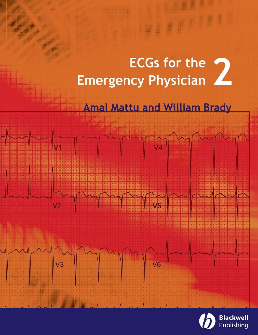 Ecgs for the Emergency Physician 2